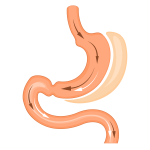 sleeve_gastrectomy_procedure